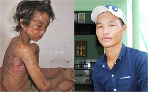 Hào Anh (Nguyễn Hoàng Anh) - cậu bé từng bị chủ đầm tôm hành hạ dã man đánh đập, dùng bàn ủi nóng gí vào người.